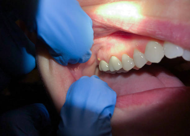 Best Emergency Treatment for Jaw Pain or Injury in Ocean Pines, MD